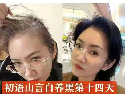 图片[3]-白养黑洗发露-妤姐甄选商城