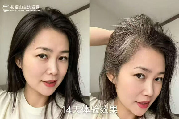 图片[4]-白养黑洗发露-妤姐甄选商城